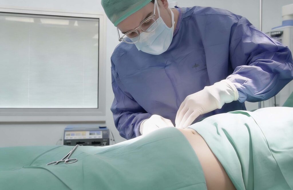 abdominoplastia realizada por el Dr. Sarria | abdominoplastia precio