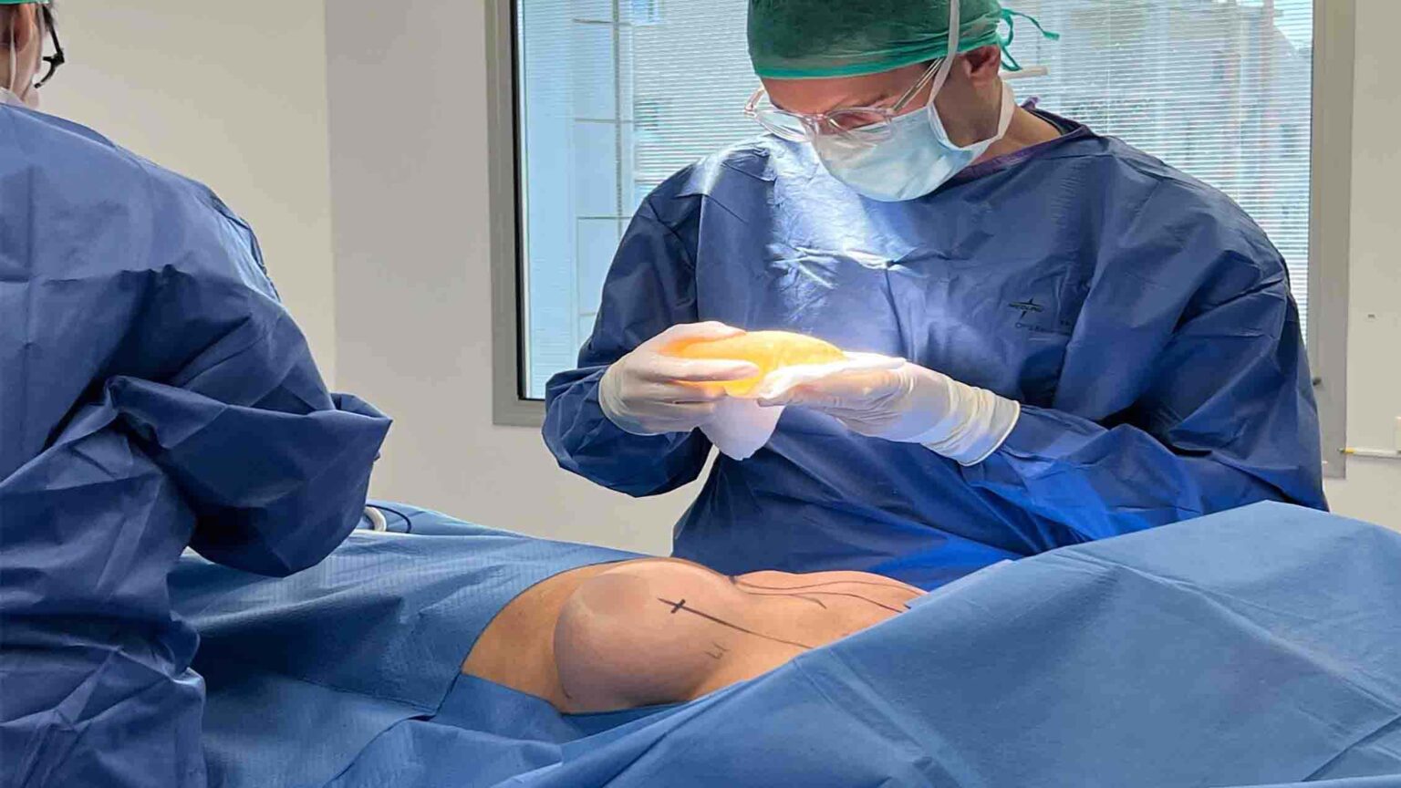 operacion de pecho con implantes con el doctor sarria | mastopexia con implantes